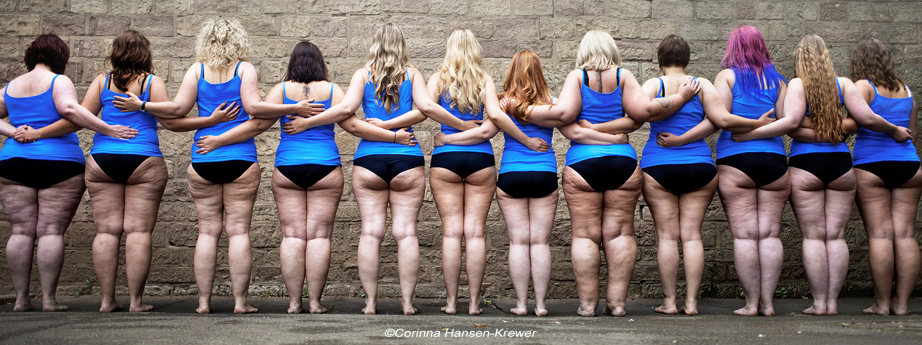 Lipoedem-Bonn_Slider-bearbeitet